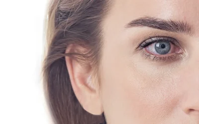 Dry Eyes vs. Allergies: How to Tell the Difference