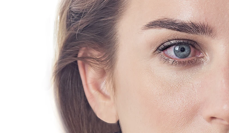 a close-up of a woman's face with a red, irritated eye